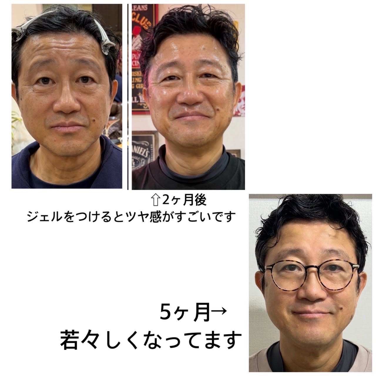 美容ジェル ご愛用者様事例3